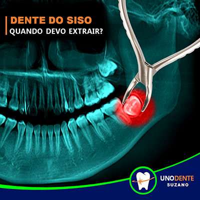 Cirurgia Odontológica em Suzano