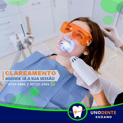 Estética - Clareamento Dental